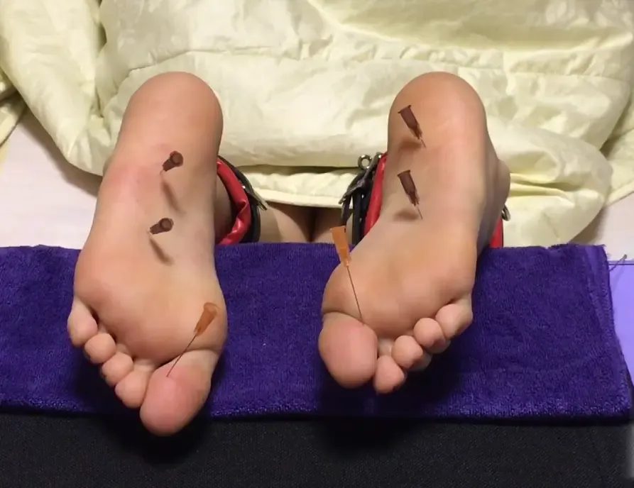悦悦针扎脚心和脚趾 悦悦针扎脚心和脚趾