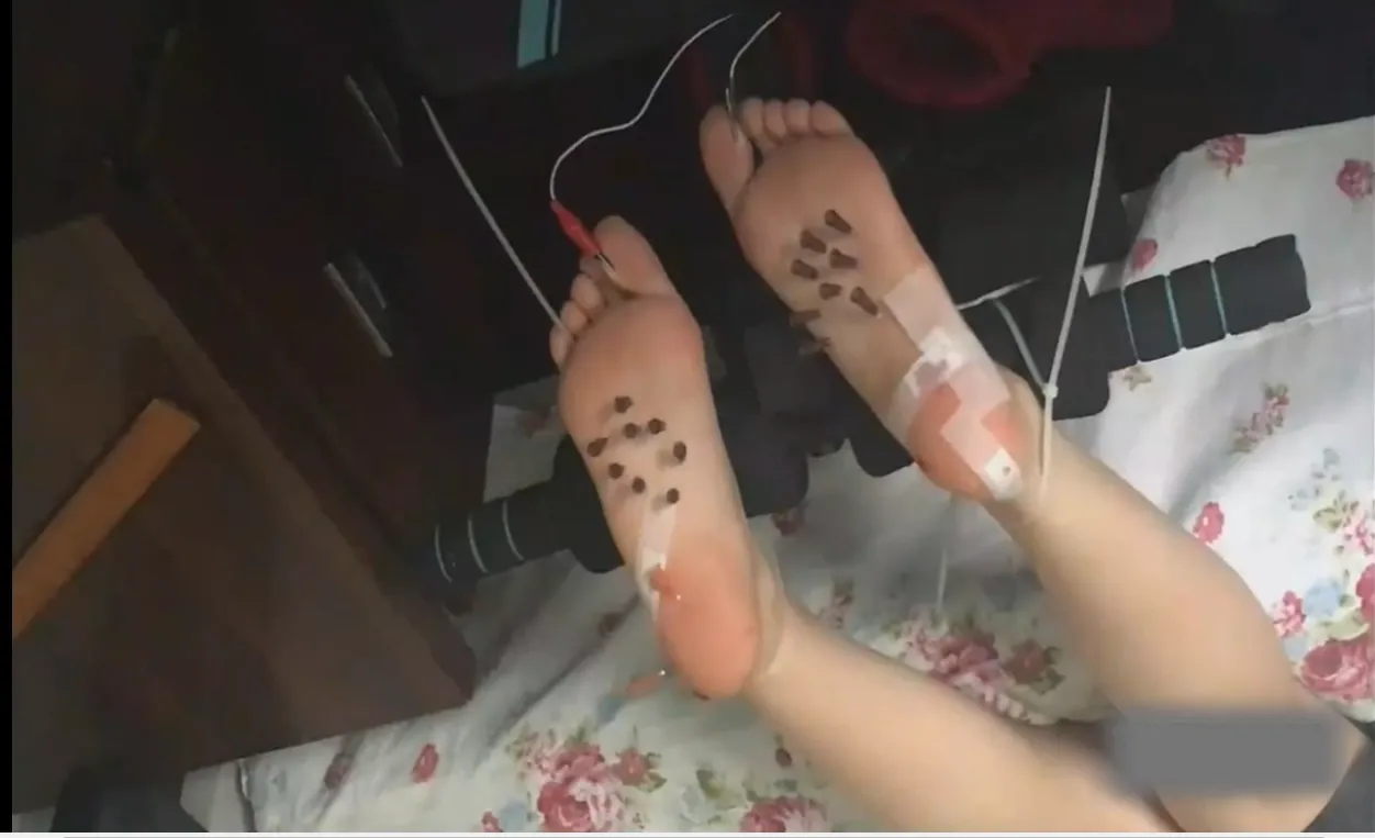 悦悦虐足扎针 悦悦虐足扎针