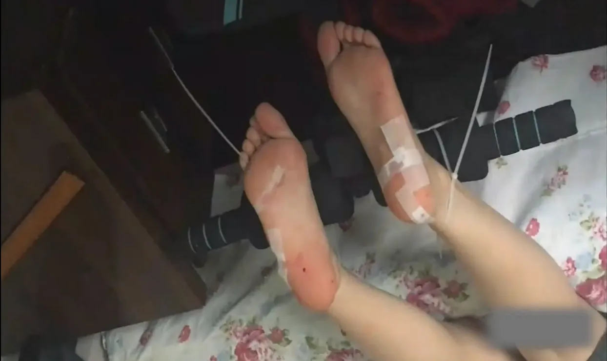 悦悦虐足扎针 悦悦虐足扎针