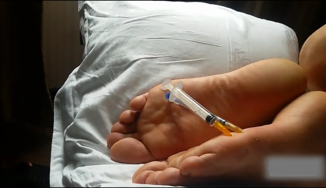 针管扎穿脚脚 针管扎穿脚脚