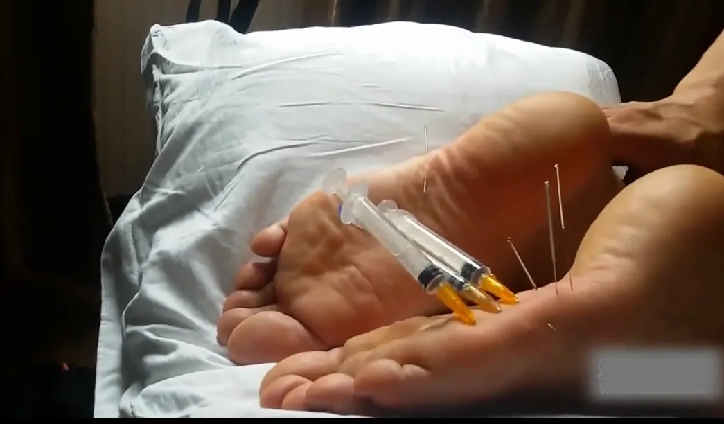 针管扎穿脚脚 针管扎穿脚脚