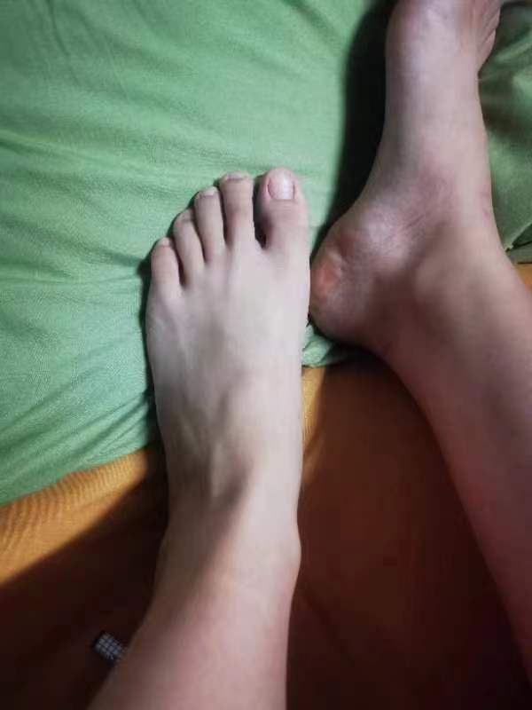 掰指-有男友的骚货 掰指-有男友的骚货