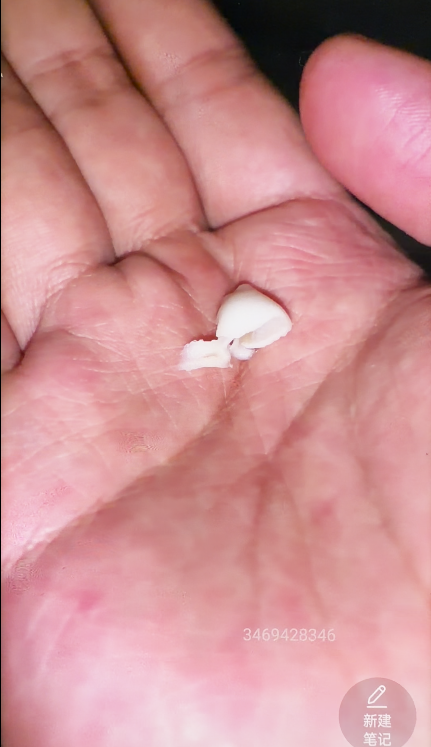 (超重口稀有)割粉嫩美脚脚趾头,超贵自购只有本站有 (超重口稀有)割粉嫩美脚脚趾头,超贵自购只有本站有