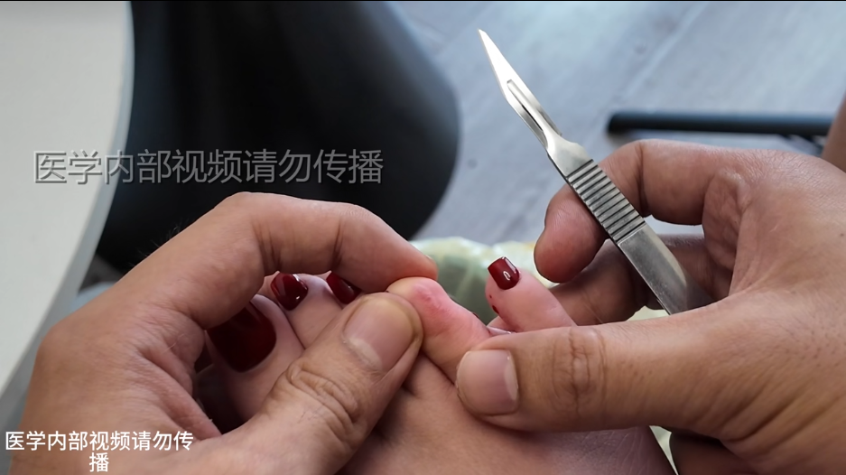 (超重口,不喜勿入)姗姗重口味割断脚趾,超贵自购 (超重口,不喜勿入)姗姗重口味割断脚趾,超贵自购